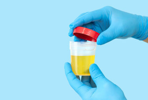 Urine Test