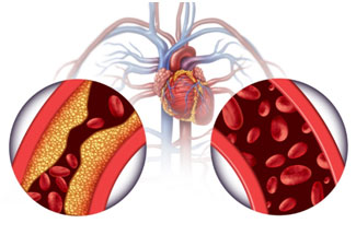 Adrenal Fatigue EDTA 