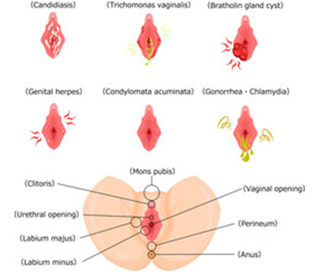 Adrenal Fatigue