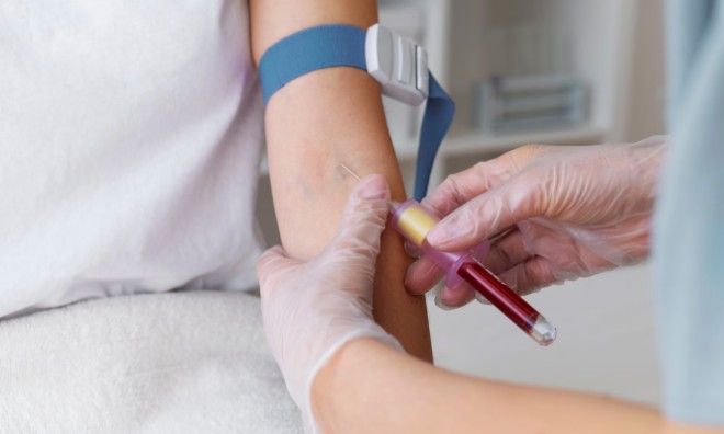 Administration of IV Therapy