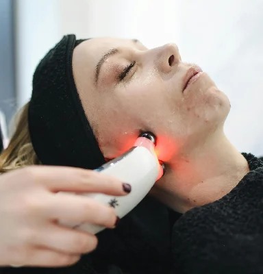 ThermiSmooth Face – Non-Surgical Skin Tightening