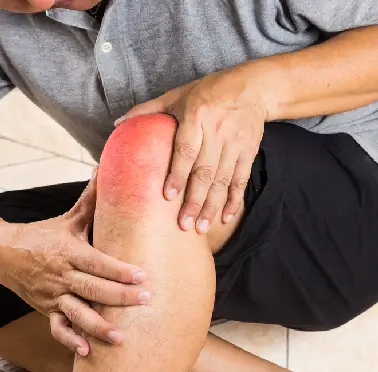 What Is Inflammation?