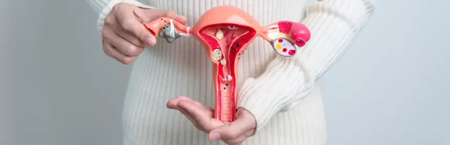 Polycystic Ovaries