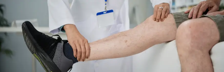 Spider & Varicose Veins