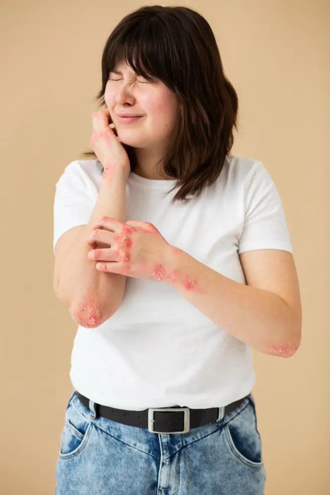 Skin rashes